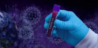148 nuevos contagios y dos fallecidos más por COVID-19 durante el fin de semana 148 nuevos contagios