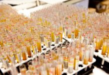 El Registro de Donantes de Muestras busca pacientes que hayan pasado el COVID-19 Registro de Donantes de Muestras
