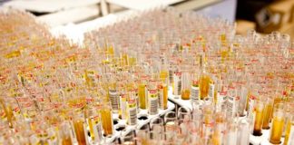 El Registro de Donantes de Muestras busca pacientes que hayan pasado el COVID-19 Registro de Donantes de Muestras